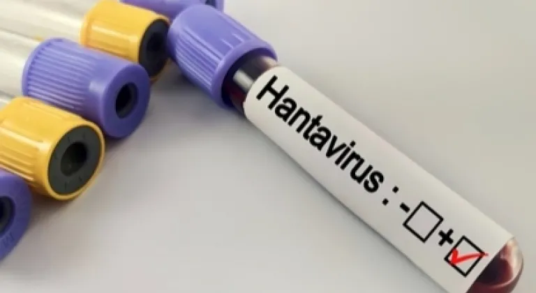 Hantavirüs salgına dönüşür mü? Kapalı alan temizliğinde büyük risk