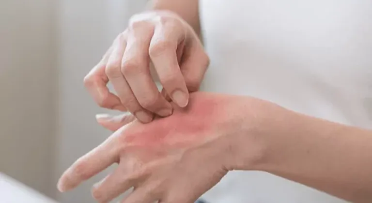 Kaşıntı yalnızca bir cilt sorunu olarak ele alınmamalı!